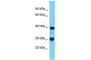Host:  Rabbit  Target Name:  Dmrtc2  Sample Type:  Mouse Stomach lysates  Antibody Dilution:  1. (DMRTC2 抗体  (C-Term))