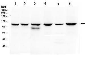 Western blot analysis of PIK3CB using anti- PIK3CB antibody .