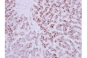 IHC-P Image Immunohistochemical analysis of paraffin-embedded human breast cancer, using EDIL3, antibody at 1:250 dilution. (EDIL3 抗体  (Center))