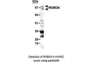 Image no. 1 for anti-Roundabout, Axon Guidance Receptor, Homolog 4 (ROBO4) (AA 900-1007), (C-Term) antibody (ABIN363598) (ROBO4 抗体  (C-Term))