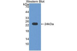 Western Blotting (WB) image for anti-Crystallin, alpha B (CRYAB) (AA 1-175) antibody (ABIN1867399) (CRYAB 抗体  (AA 1-175))
