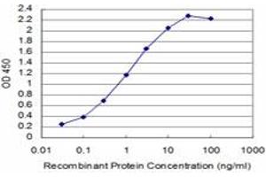 Detection limit for recombinant GST tagged SIX4 is approximately 0. (SIX4 抗体  (AA 672-780))