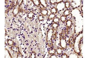 Paraformaldehyde-fixed, paraffin embedded rat kidney, Antigen retrieval by boiling in sodium citrate buffer (pH6) for 15min, Block endogenous peroxidase by 3% hydrogen peroxide for 30 minutes,  Blocking buffer (normal goat serum) at 37°C for 20min, Antibody incubation with HDAC6 Polyclonal Antibody (bs-2811R) at 1:400 overnight at 4°C, followed by a conjugated secondary and DAB staining. (HDAC6 抗体  (AA 301-400))