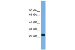 BCL7A antibody used at 1 ug/ml to detect target protein. (BCL7A 抗体  (Middle Region))