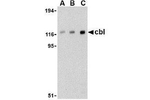 Western blot analysis of cbl in Daudi cell lysate with AP30209PU-N cbl antibody at (A) 0. (CBL 抗体  (C-Term))