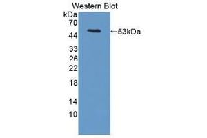 Detection of Recombinant LRG1, Mouse using Polyclonal Antibody to Leucine Rich Alpha-2-Glycoprotein 1 (LRG1) (LRG1 抗体  (AA 136-342))