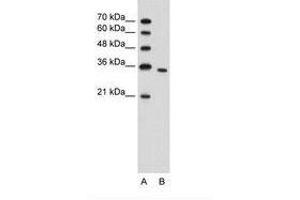 Image no. 1 for anti-phosphoribosyl Pyrophosphate Synthetase 2 (PRPS2) (N-Term) antibody (ABIN203391) (PRPS2 抗体  (N-Term))