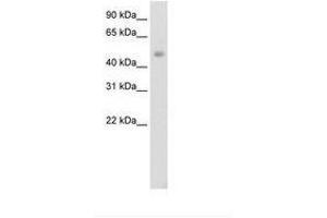 Image no. 1 for anti-Jumonji Domain Containing 6 (JMJD6) (AA 296-345) antibody (ABIN202365) (JMJD6 抗体  (AA 296-345))