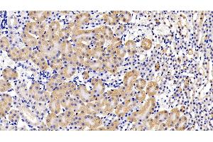 Detection of LIFR in Mouse Kidney Tissue using Polyclonal Antibody to Leukemia Inhibitory Factor Receptor (LIFR) (LIFR 抗体  (AA 151-290))