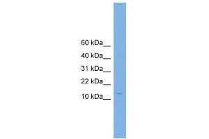 WB Suggested Anti-CPLX2 Antibody Titration: 0. (CPLX2 抗体  (N-Term))