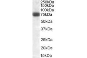 Western Blotting (WB) image for anti-delta-Like 1 (DLL1) (Internal Region) antibody (ABIN361190)