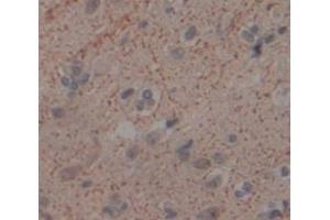 IHC-P analysis of Human Tissue, with DAB staining. (FKBP10 抗体  (AA 158-440))