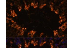 Immunofluorescence analysis of Rat testis using OXCT2 Polyclonal Antibody at dilution of 1:100. (OXCT2 抗体)