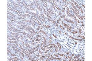 IHC analysis of PAP/ACP3 using anti-PAP/ACP3 antibody (ABIN7600122). (ACPP 抗体  (AA 150-386))