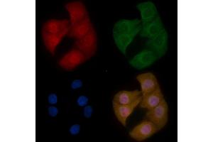 MeCP2 Mouse Monoclonal Antibody staining Hela cells by IF/ICC.