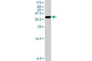 Western Blot detection against Immunogen (34. (GLIPR1 抗体  (AA 23-99))