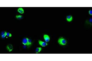 Immunofluorescence staining of MCF-7 cells with ABIN7151731 at 1:133, counter-stained with DAPI. (ECSCR 抗体  (AA 25-124))