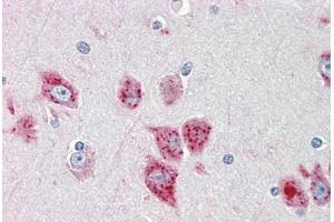 Human Brain, Cortex: Formalin-Fixed, Paraffin-Embedded (FFPE) (ANKH 抗体  (AA 464-492))