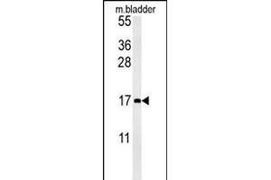 CCL4 Antibody (Center) (ABIN654131 and ABIN2850474) western blot analysis in mouse bladder tissue lysates (15 μg/lane). (CCL4 抗体  (AA 22-48))