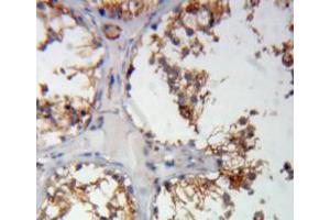 Used in DAB staining on fromalin fixed paraffin-embedded testis tissue (COMP 抗体  (AA 123-240))