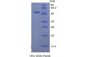 SDS-PAGE analysis of Rat EGFR2 Protein. (EGFR2 蛋白)