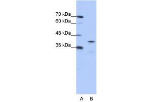 CPEB2 antibody used at 0. (CPEB2 抗体  (Middle Region))