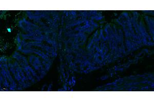 Paraformaldehyde-fixed, paraffin embedded Rat colon; Antigen retrieval by boiling in sodium citrate buffer (pH6. (MTM1 抗体  (AA 225-275))