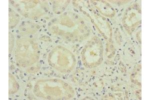 Immunohistochemistry of paraffin-embedded human kidney tissue using ABIN7175282 at dilution of 1:100 (VPS11 抗体  (AA 692-941))