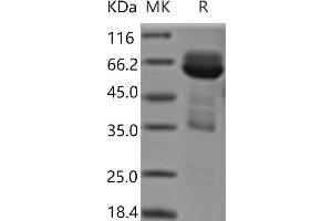 Western Blotting (WB) image for Cell Adhesion Molecule 3 (CADM3) protein (Fc Tag) (ABIN7321188) (CADM3 Protein (Fc Tag))