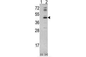 Western blot analysis of MVD (arrow) using rabbit polyclonal MVD Antibody (N-term) . (MVD 抗体  (N-Term))