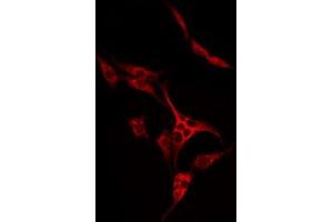 ABIN6274977 staining LOVO by IF/ICC. (SLC7A4 抗体  (C-Term))