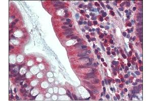 Human Small Intestine: Formalin-Fixed, Paraffin-Embedded (FFPE) (CA1 抗体  (Internal Region))