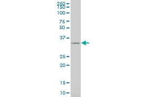 SIX3 monoclonal antibody (M02), clone 3F1 Western Blot analysis of SIX3 expression in 293 . (SIX3 抗体  (AA 273-332))