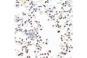 Immunohistochemistry of paraffin-embedded mouse lung using SFPQ antibody (ABIN5970351) at dilution of 1/100 (40x lens). (SFPQ 抗体)