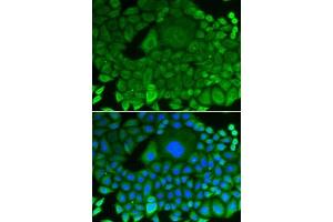 Immunofluorescence analysis of HeLa cells using RhoGDI antibody (ABIN3021743, ABIN3021744, ABIN3021745 and ABIN1512595). (ARHGDIA 抗体  (AA 1-204))
