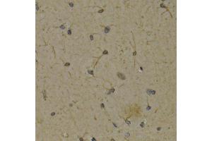 Immunohistochemistry (IHC) image for anti-Arachidonate 5-Lipoxygenase (ALOX5) (AA 1-300) antibody (ABIN3023073) (ALOX5 抗体  (AA 1-300))