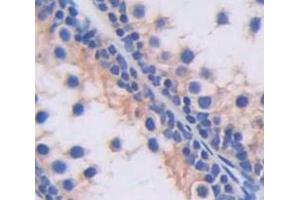 IHC-P analysis of Human Tissue, with DAB staining. (SLC2A14 抗体  (AA 230-293))