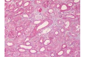 Immunohistochemistry (IHC) image for anti-ATP-Binding Cassette, Sub-Family B (MDR/TAP), Member 1 (ABCB1) (AA 255-280) antibody (ABIN129711)