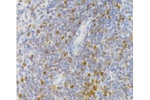 Immunohistochemistry of paraffin-embedded Rat spleen using NASP Polyclonal Antibody at dilution of 1:100 (40x lens). (NASP 抗体)