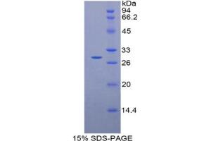 SDS-PAGE analysis of Rat TTK Protein Kinase Protein. (Mps1 Protein (TTK))