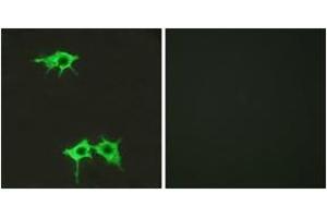 Immunofluorescence analysis of LOVO cells, using FZD4 Antibody. (FZD4 抗体  (AA 131-180))