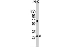 Western blot analysis of LIN28B polyclonal antibody  in HL-60 cell line lysates (35 ug/lane). (LIN28B 抗体  (N-Term))