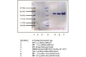 Gel Scan of Bacterial/Permeability-Increasing Protein, Human Neutrophil  (BPI, CAP57)  This information is representative of the product ART prepares, but is not lot specific. (BPI 蛋白)