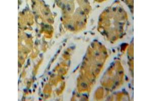 Immunohistochemistry (IHC) image for anti-Enolase 1 (ENO1) (AA 1-434) antibody (ABIN1860012)