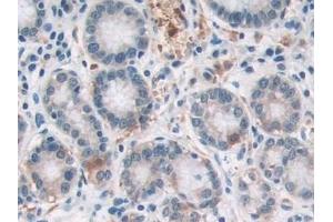 Detection of SOCS2 in Human Stomach Tissue using Polyclonal Antibody to Suppressors Of Cytokine Signaling 2 (SOCS2)