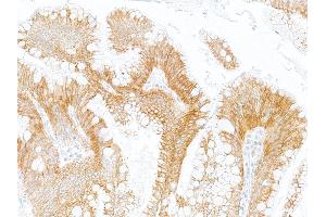 Immunohistochemistry (IHC) image for anti-Oxidized Low Density Lipoprotein (Lectin-Like) Receptor 1 (OLR1) (AA 61-273) antibody (ABIN7795657)