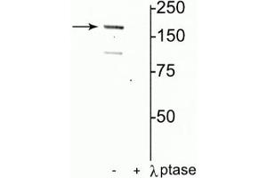 Western blot of rat hippocampal lysate showing specific immunolabeling of the ~180 kDa NR2A subunit of the NMDAR phosphorylated at Tyr1325 in the first lane (-). (NMDAR2A 抗体  (pTyr1325))