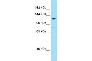 WB Suggested Anti-GRID2IP Antibody Titration: 1. (GRID2IP 抗体  (Middle Region))