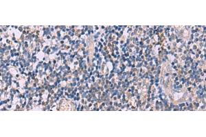 Immunohistochemistry of paraffin-embedded Human tonsil tissue using IL4R Polyclonal Antibody at dilution of 1:45(x200) (IL4 Receptor 抗体)
