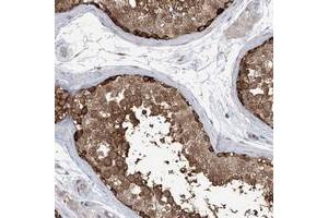 Immunohistochemical staining of human testis with KAAG1 polyclonal antibody  shows strong positivity in a subset of cells in seminiferus ducts at 1:50-1:200 dilution. (KAAG1 抗体)